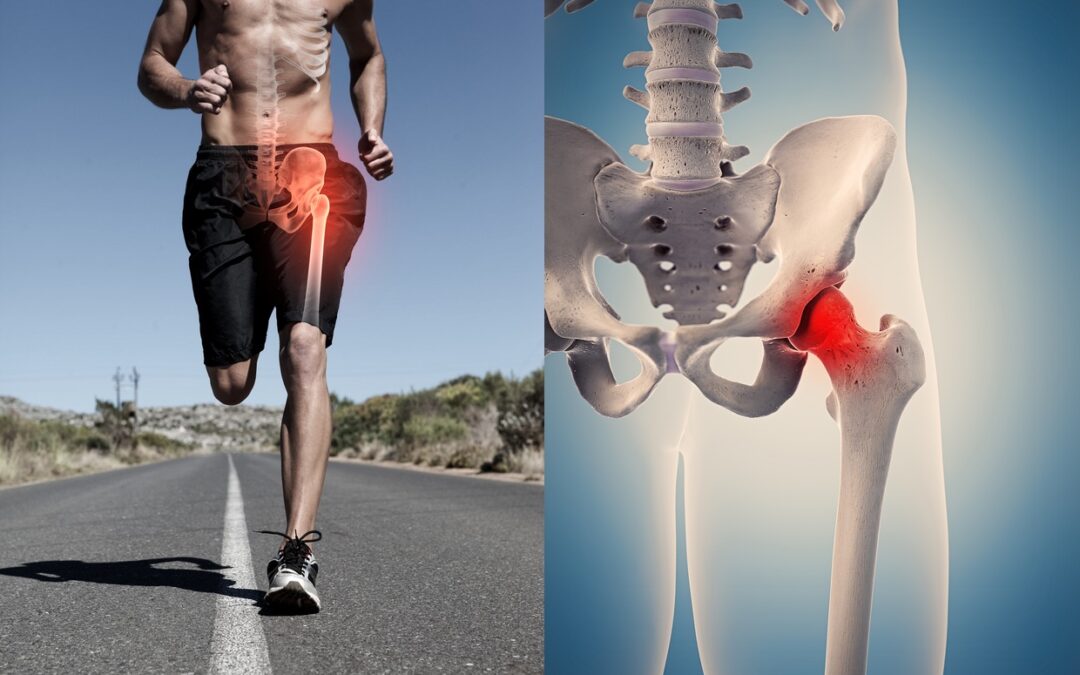 Anatomia dell’anca, come influenza lo sport e le attività quotidiane!